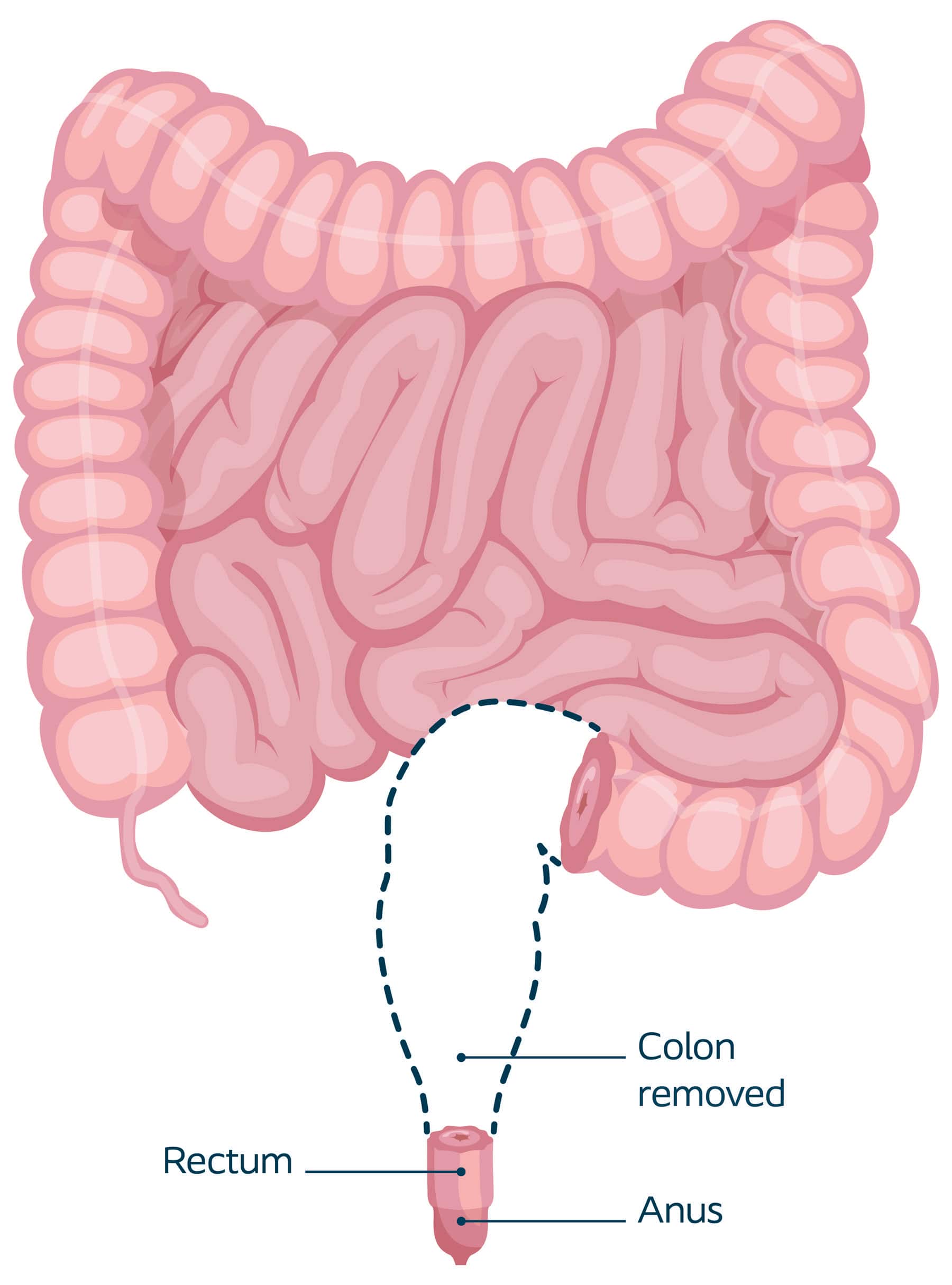 Colon