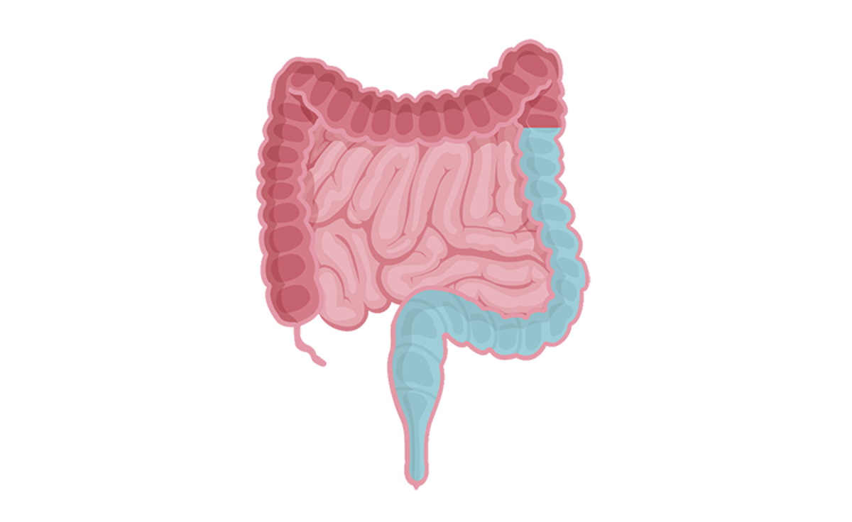 Wat loopt er fout bij fecale incontinentie en obstipatie?